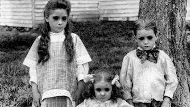 black-eyed-childrens-la-gi