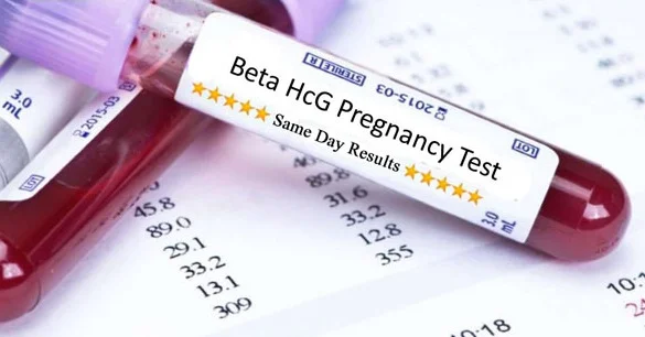 Xet-nghiem-hCG