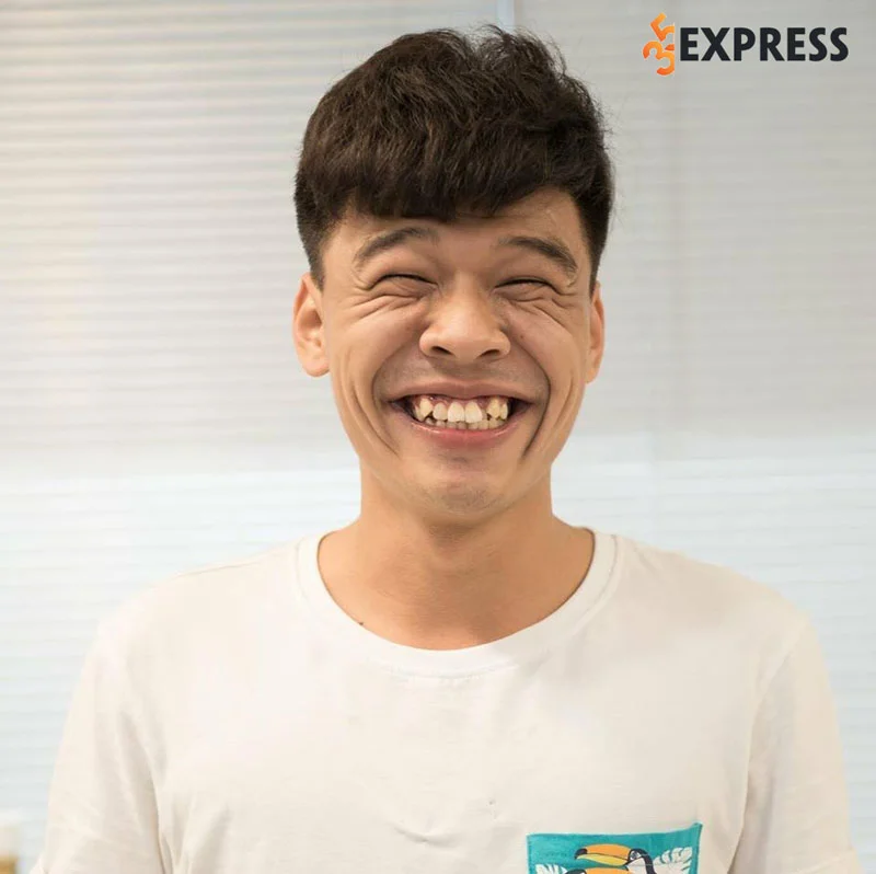 hinh-anh-xau-la-cua-nghe-si-trung-ruoi-35express