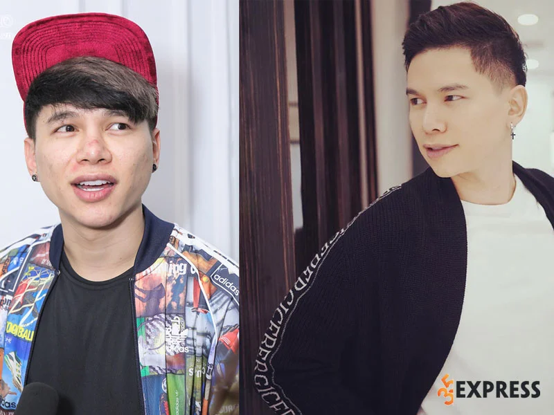 dien-mao-moi-cua-hoang-ton-sau-phau-thuat-tham-my-35express