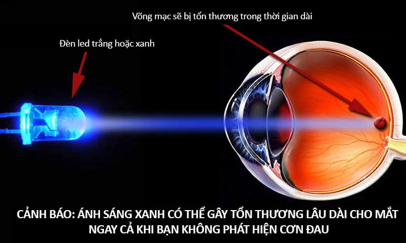 tac-hai-cua-anh-sang-xanh-voi-mat-35express