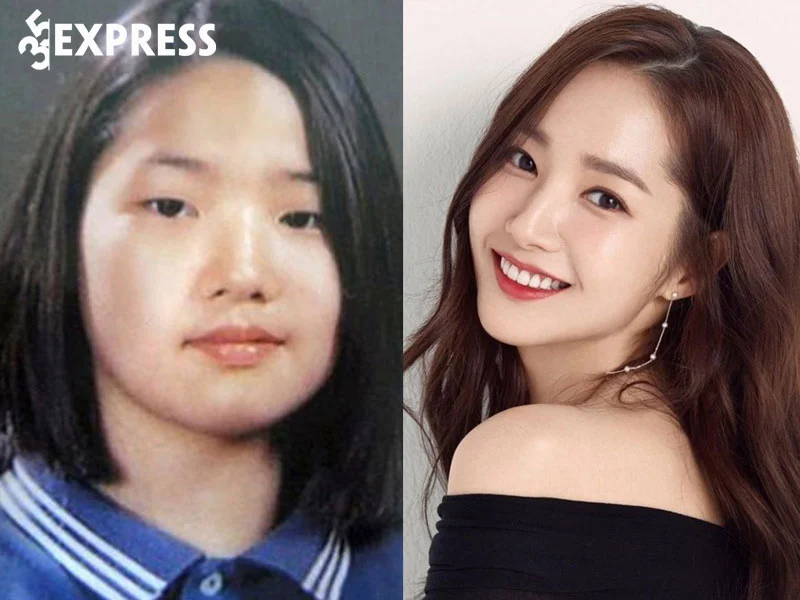 park-min-young-thua-nhan-phau-thuat-tham-my-35express