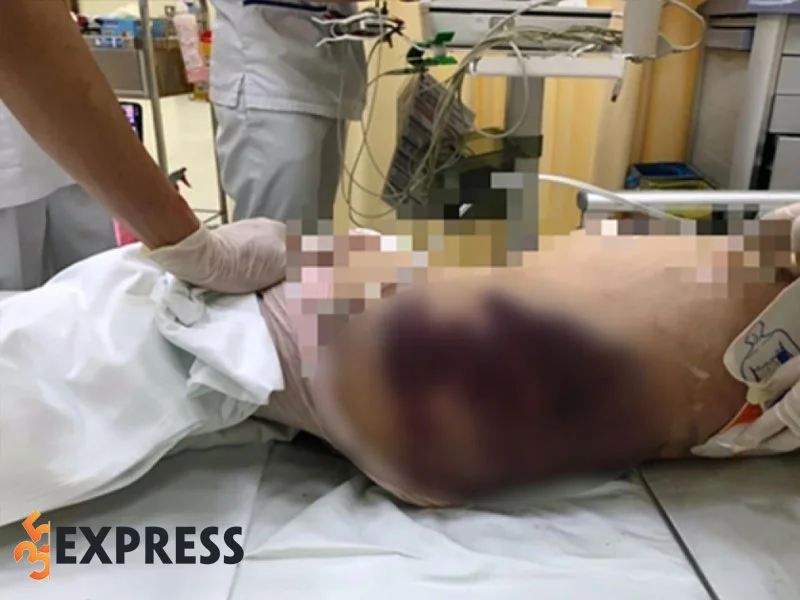 muc-hinh-phat-di-ghe-vo-nguyen-quynh-trang-hanh-ha-be-gai-8-tuoi-tu-vong-35express