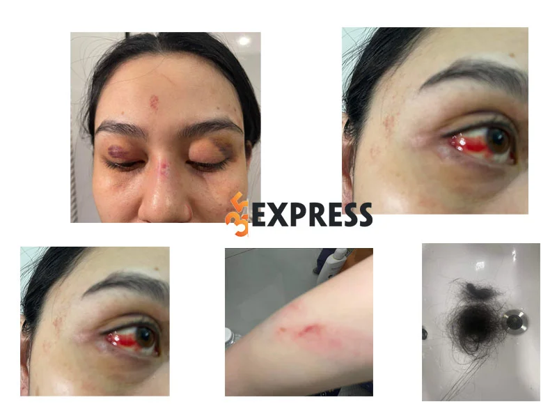 dien-bien-cau-chuyen-chi-xa-hoi-cua-tran-my-bi-nhan-vien-trang-nemo-hanh-hung-2-35express