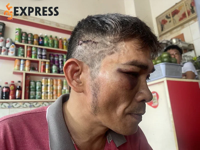 che-phi-con-trai-ca-si-che-linh-bi-danh-hoi-dong-guc-o-chung-cu-35express