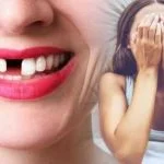 Mơ thấy rụng răng và những con số liên quan