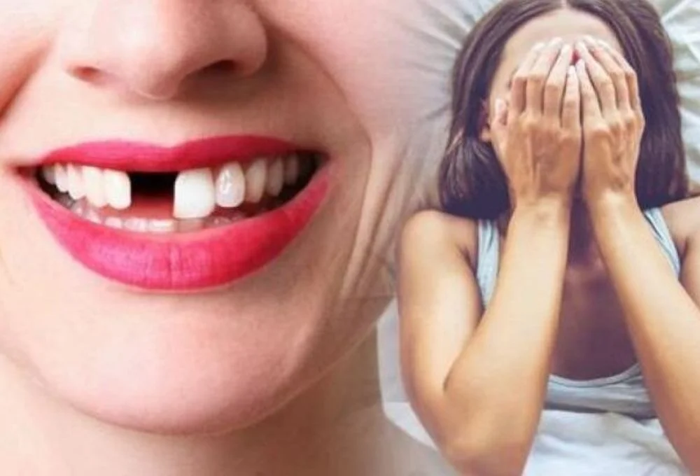 Tại sao lại mơ thấy rụng răng?