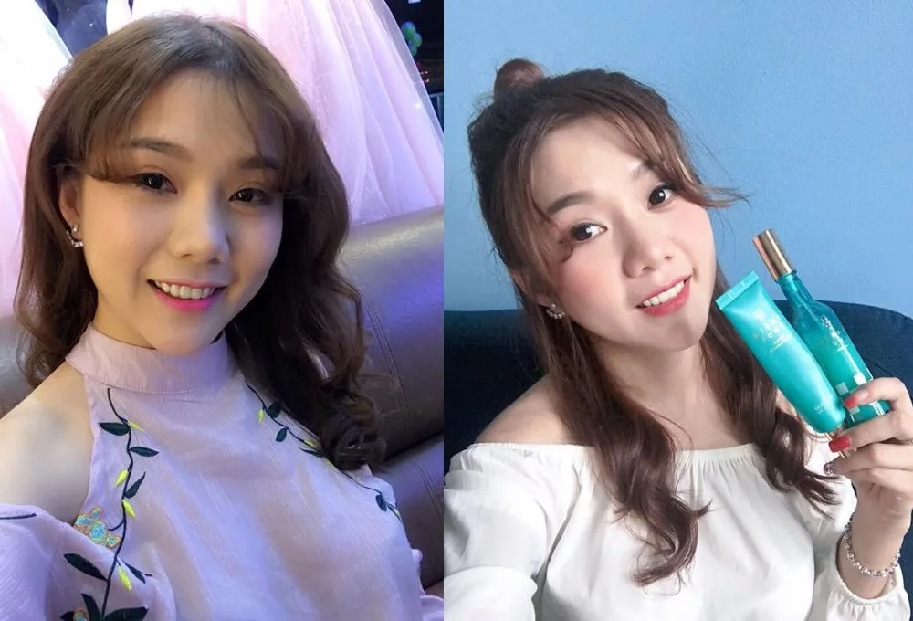 Suri Kim là ai?